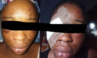 Jealous ex-boyfriend brutally assaults undergraduate