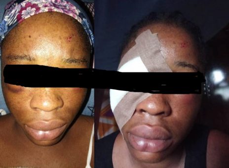 Jealous ex-boyfriend brutally assaults undergraduate