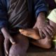 Africa CDC declares mpox public health emergency