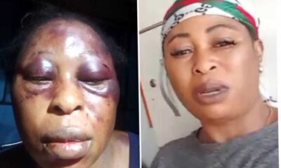 (PHOTOS): Mother of Three Beaten by Neighbours Over Prepaid Meter's Recharge 