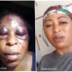 (PHOTOS): Mother of Three Beaten by Neighbours Over Prepaid Meter's Recharge 