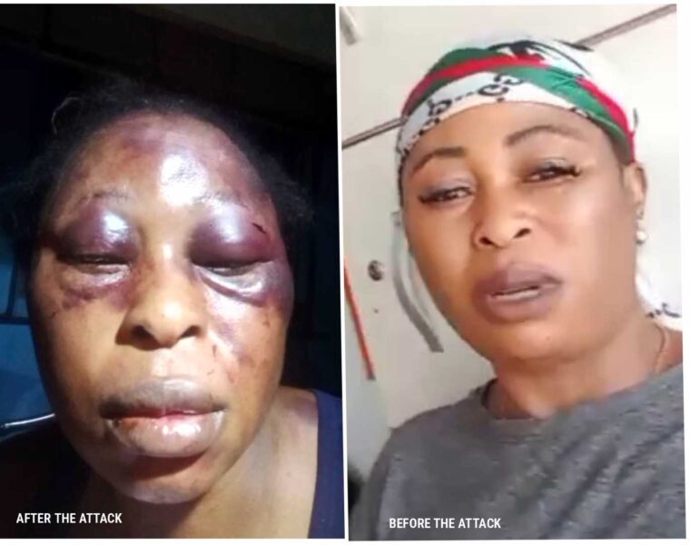 (PHOTOS): Mother of Three Beaten by Neighbours Over Prepaid Meter's Recharge 