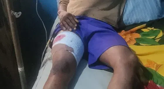 Police Arrest Top Commissioner Over Gunshots at APC Rally (PHOTO)